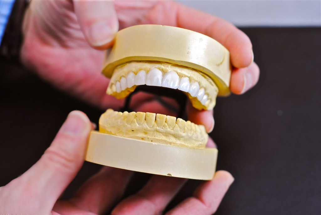 Diagnostic Waxup Blue Crane Dental Lab